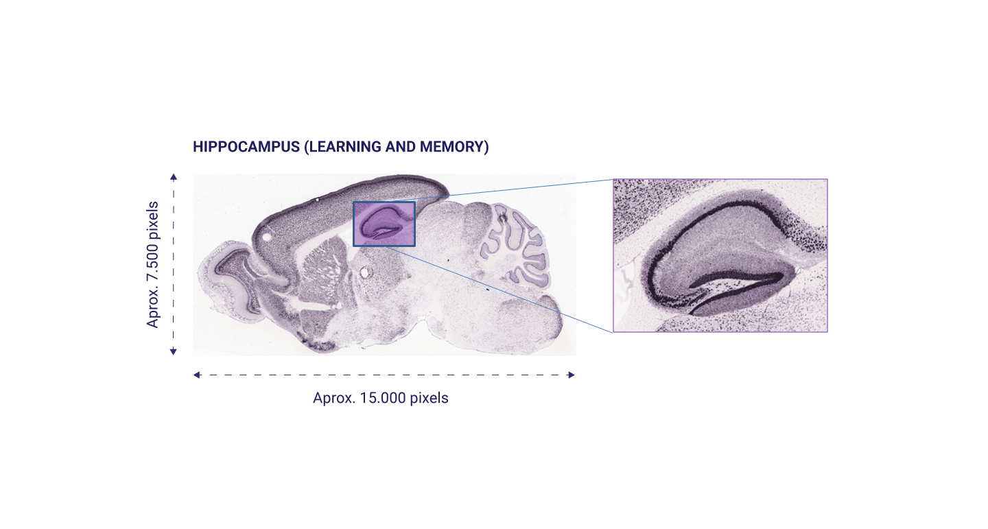 Automatic segmentation and localization of the hippocampus in ...