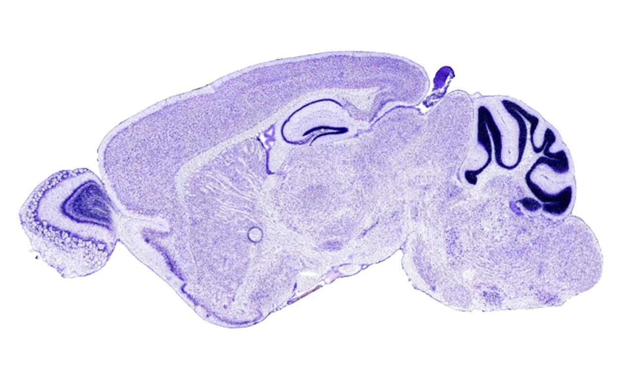 Segmentación y localización automática del hipocampo en imágenes histológicas