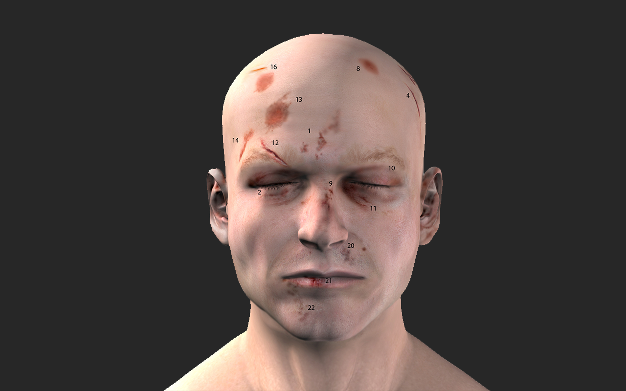 Evidential Presentation and Forensic Injury Depiction for courts